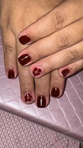 Esmaltação em gel
